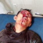 Dirampok dalam Angkot, Leher Ahmad Ditikam dan Dibuang ke Semak-Semak